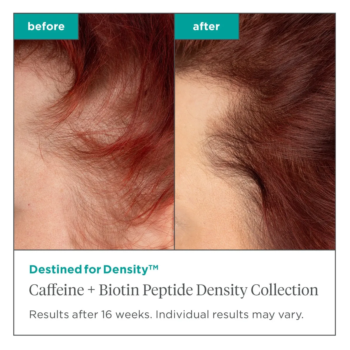 Destined For Density Vegan Omega 3, 6, 9   Biotin Supplements For Healthy Hair
